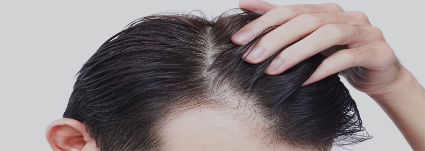 Hair Transplants in Thailand: Frequently Asked Questions